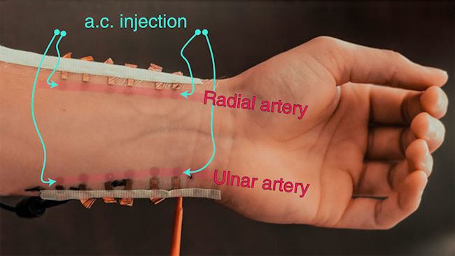 Photo of multiplexed tattoo placement