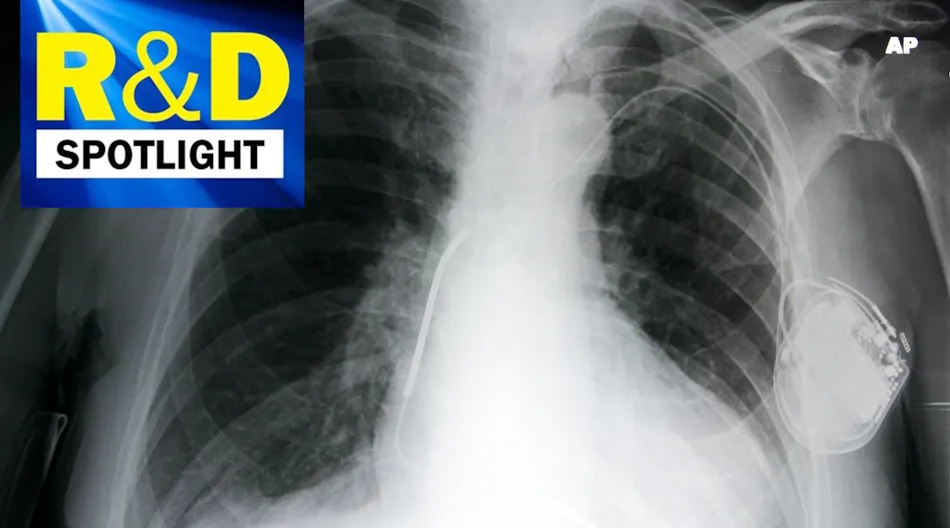 R&D Spotlight: Never Skip a Beat: Pacemaker Trials Strive for Leadless ...