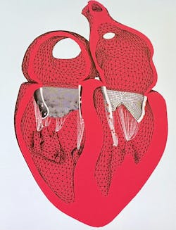 Being able to operate on a simulation of a patient heart repeatedly before undergoing the procedure on the actual patient facilitates the best possible patient outcome. Being able to operate on a simulation of a patient heart repeatedly before undergoing the procedure on the actual patient facilitates the best possible patient outcome.