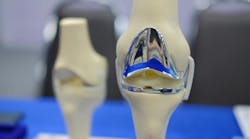 Knee joint model after replacement surgery Knee joint model after replacement surgery