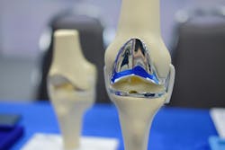 Knee joint model after replacement surgery Knee joint model after replacement surgery