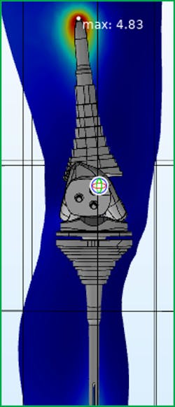 This image shows a temperature rise on a full knee replacement during exposure to a 1.5 T MRI coil. This image shows a temperature rise on a full knee replacement during exposure to a 1.5 T MRI coil.