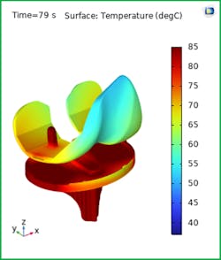 This image shows the temperature on the articulating surface where the metallic femoral component slides over the tibial tray. This image shows the temperature on the articulating surface where the metallic femoral component slides over the tibial tray.